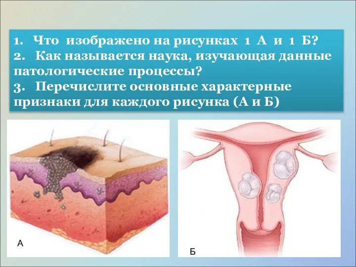 1. Что изображено на рисунках 1 А и 1 Б? 2. Как