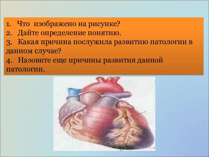 1. Что изображено на рисунке? 2. Дайте определение понятию. 3. Какая причина