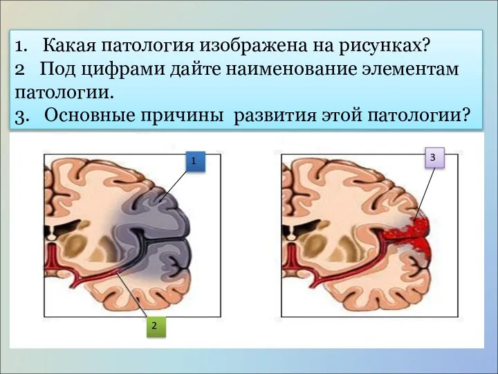 1. Какая патология изображена на рисунках? 2 Под цифрами дайте наименование элементам