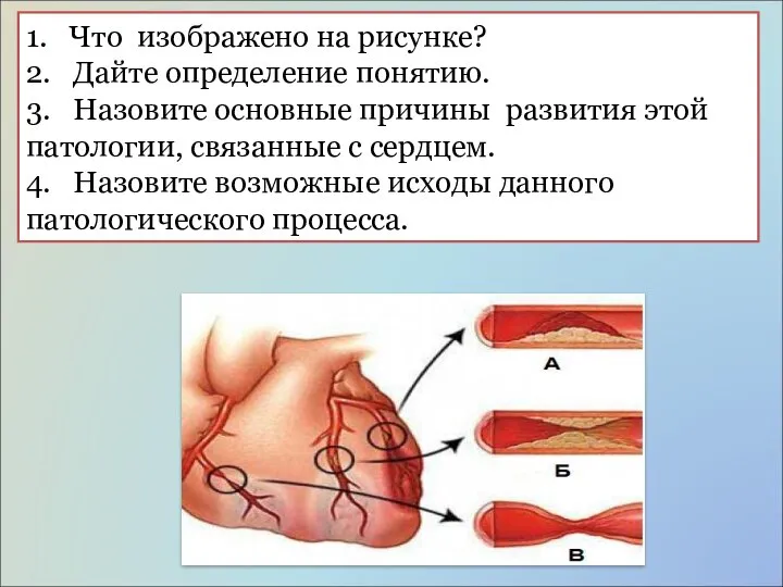 1. Что изображено на рисунке? 2. Дайте определение понятию. 3. Назовите основные