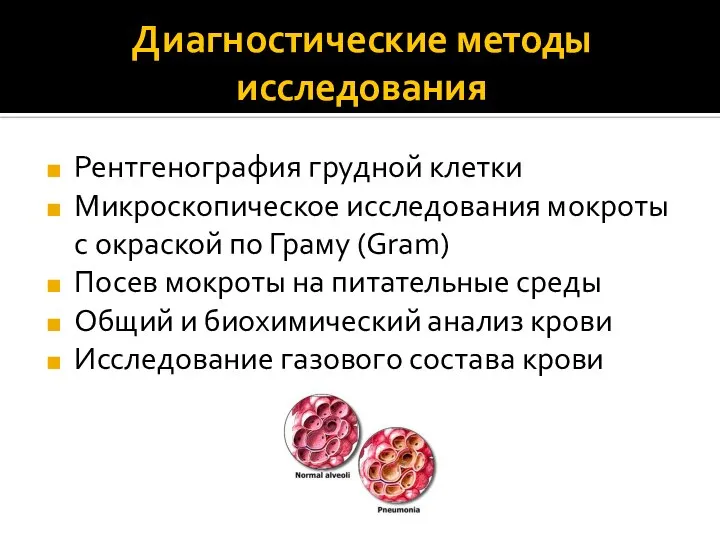 Диагностические методы исследования Рентгенография грудной клетки Микроскопическое исследования мокроты с окраской по