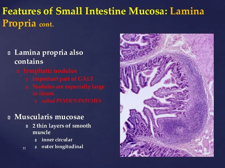 Features of Small Intestine Mucosa: Lamina Propria cont. Lamina propria also contains