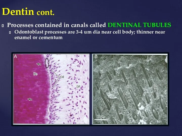 Dentin cont. Processes contained in canals called DENTINAL TUBULES Odontoblast processes are