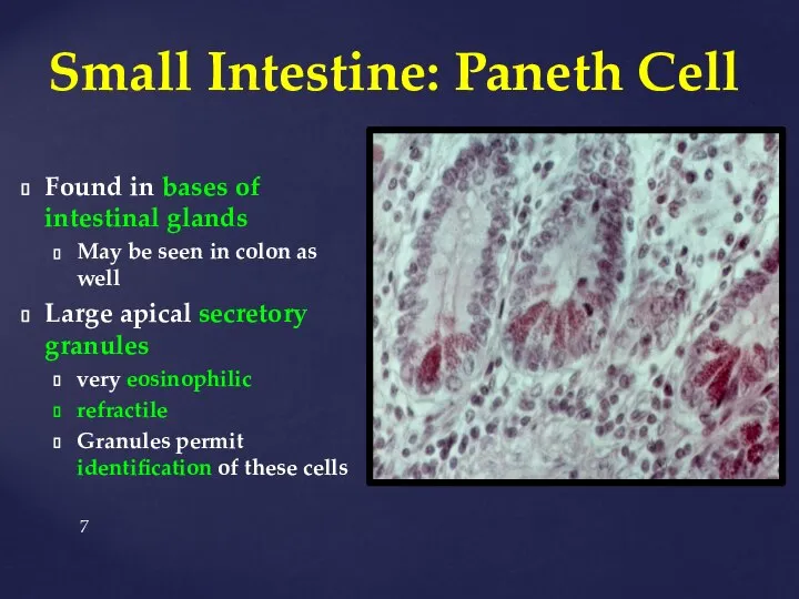 Small Intestine: Paneth Cell Found in bases of intestinal glands May be