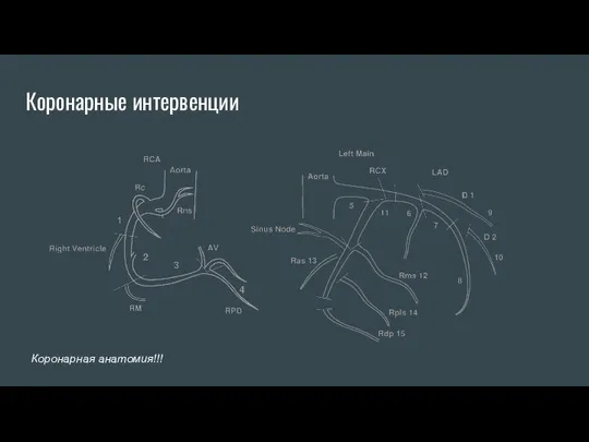 Коронарные интервенции Коронарная анатомия!!!