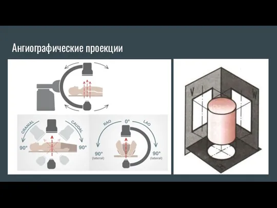 Ангиографические проекции