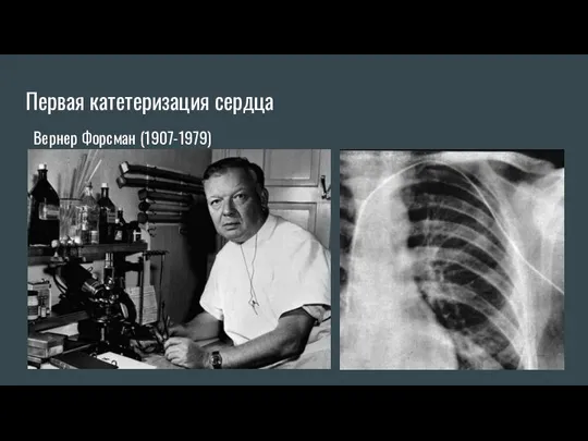 Первая катетеризация сердца Вернер Форсман (1907-1979)