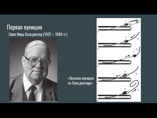 Первая пункция Свен Ивар Сельдингер (1921 – 1988 гг.) «Техника пункции по Сельдингеру»