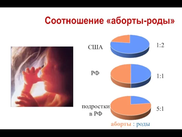 1:2 1:1 5:1 аборты : роды США РФ подростки в РФ