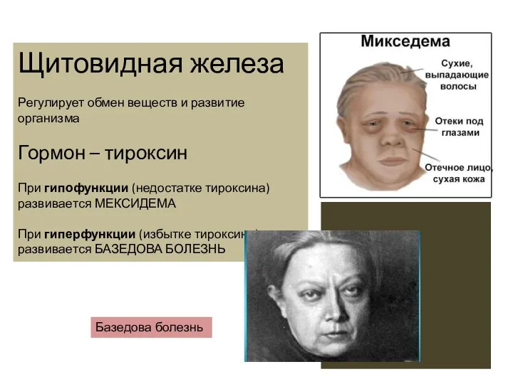 Щитовидная железа Регулирует обмен веществ и развитие организма Гормон – тироксин При