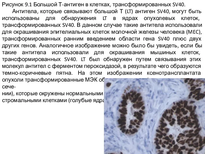 Рисунок 9.1 Большой Т-антиген в клетках, трансформированных SV40. Антитела, которые связывают большой