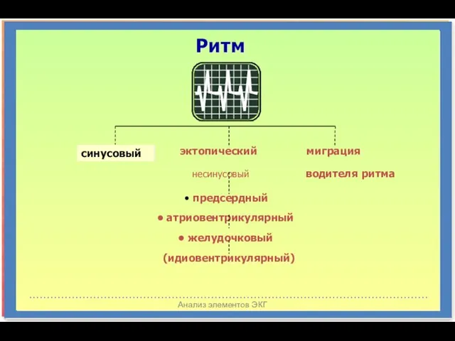 Анализ элементов ЭКГ эктопический миграция несинусовый водителя ритма предсердный атриовентрикулярный желудочковый (идиовентрикулярный) синусовый Ритм