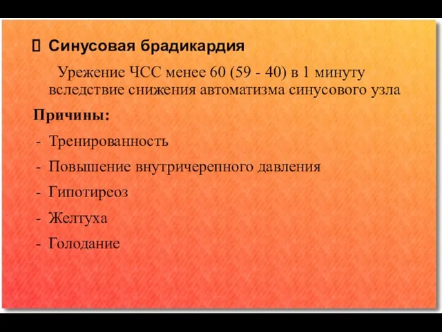 Синусовая брадикардия Урежение ЧСС менее 60 (59 - 40) в 1 минуту