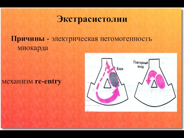 Причины - электрическая негомогенность миокарда Экстрасистолии 10.02.2016 механизм re-entry