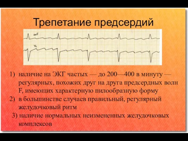 Трепетание предсердий наличие на ЭКГ частых — до 200—400 в минуту —