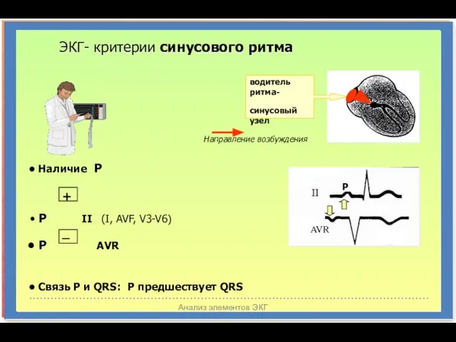 Анализ элементов ЭКГ водитель ритма- синусовый узел ЭКГ- критерии синусового ритма Р II AVR Направление возбуждения