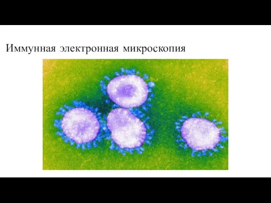 Иммунная электронная микроскопия