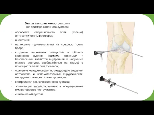 Этапы выполнения артроскопии (на примере коленного сустава) обработка операционного поля (колена) антисептическим