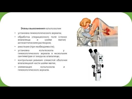 Этапы выполнения кольпоскопии установка гинекологического зеркала; обработка операционного поля (стенок влагалища и