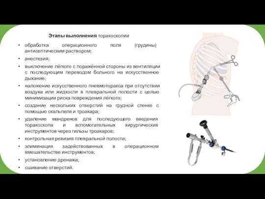 Этапы выполнения торакоскопии обработка операционного поля (грудины) антисептическим раствором; анестезия; выключение лёгкого