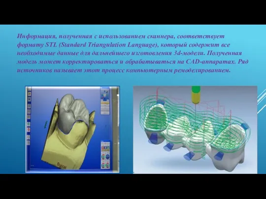 Информация, полученная с использованием сканнера, соответствует формату STL (Standard Triangulation Language), который