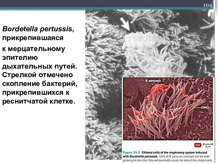 Bordetella pertussis, прикрепившаяся к мерцательному эпителию дыхательных путей. Стрелкой отмечено скопление бактерий, прикрепившихся к реснитчатой клетке.