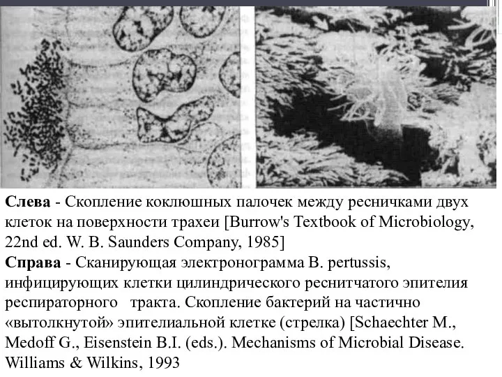 Слева - Скопление коклюшных палочек между ресничками двух клеток на поверхности трахеи