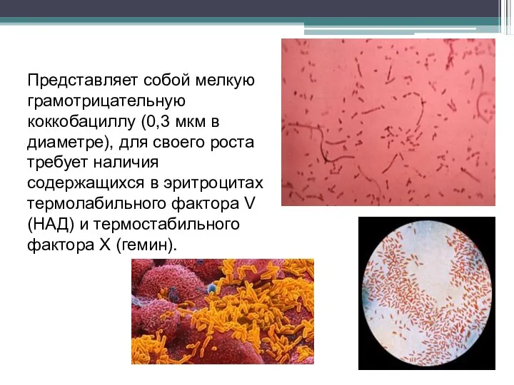 Представляет собой мелкую грамотрицательную коккобациллу (0,3 мкм в диаметре), для своего роста