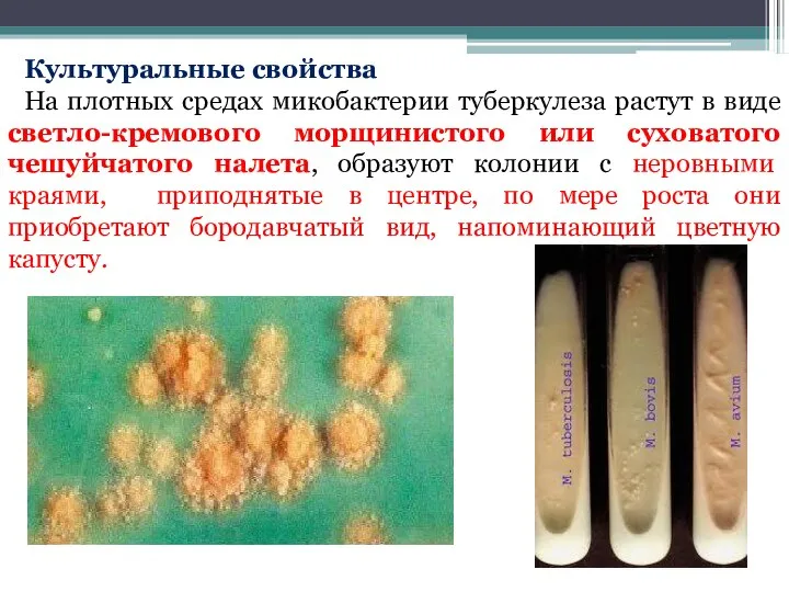 Культуральные свойства На плотных средах микобактерии туберкулеза растут в виде светло-кремового морщинистого