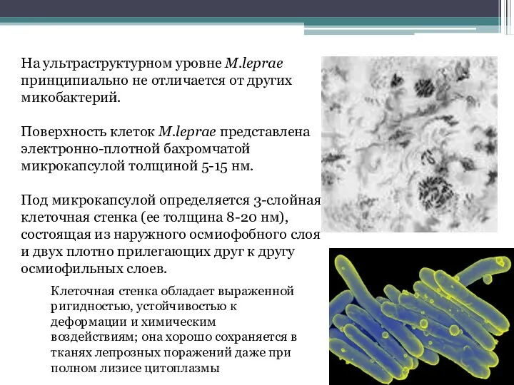 На ультраструктурном уровне M.leprae принципиально не отличается от других микобактерий. Поверхность клеток