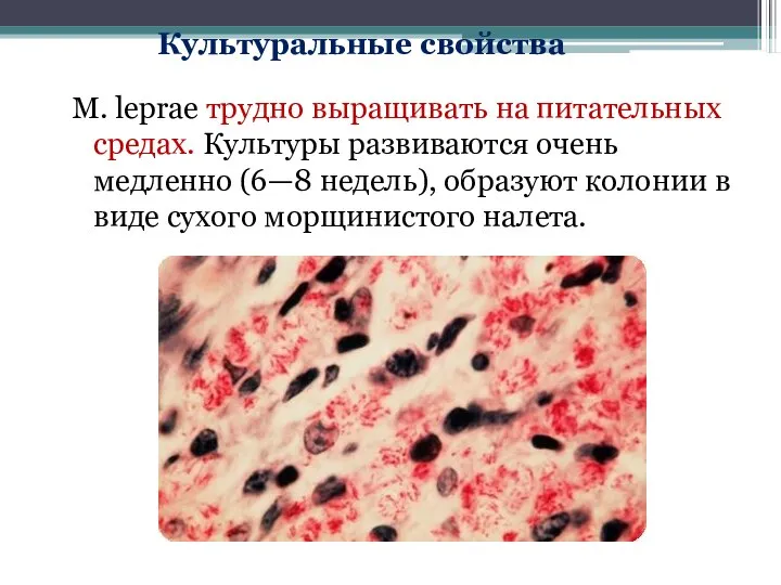 M. leprae трудно выращивать на питательных средах. Культуры развиваются очень медленно (6—8