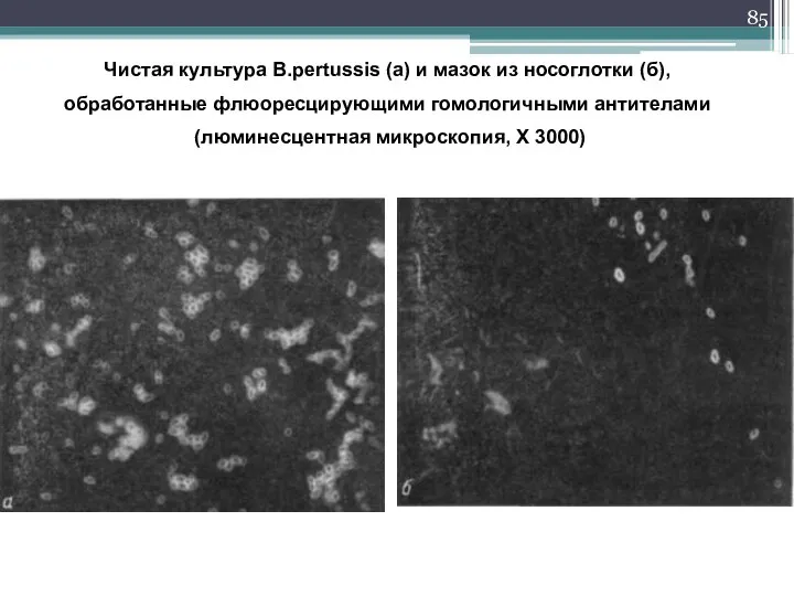 Чистая культура B.pertussis (а) и мазок из носоглотки (б), обработанные флюоресцирующими гомологичными