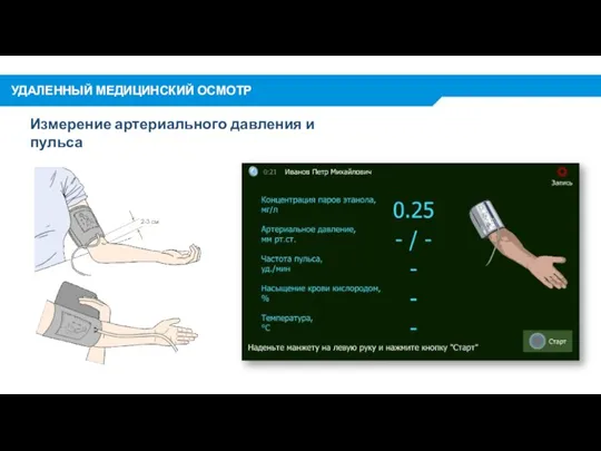 Измерение артериального давления и пульса УДАЛЕННЫЙ МЕДИЦИНСКИЙ ОСМОТР