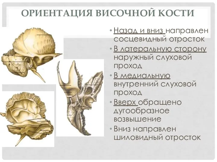 ОРИЕНТАЦИЯ ВИСОЧНОЙ КОСТИ Назад и вниз направлен сосцевидный отросток В латеральную сторону