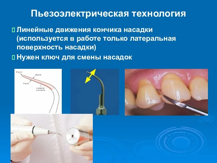 Пьезоэлектрическая технология Линейные движения кончика насадки (используется в работе только латеральная поверхность