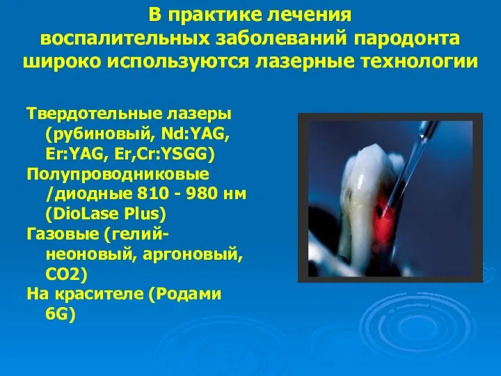 В практике лечения воспалительных заболеваний пародонта широко используются лазерные технологии Твердотельные лазеры