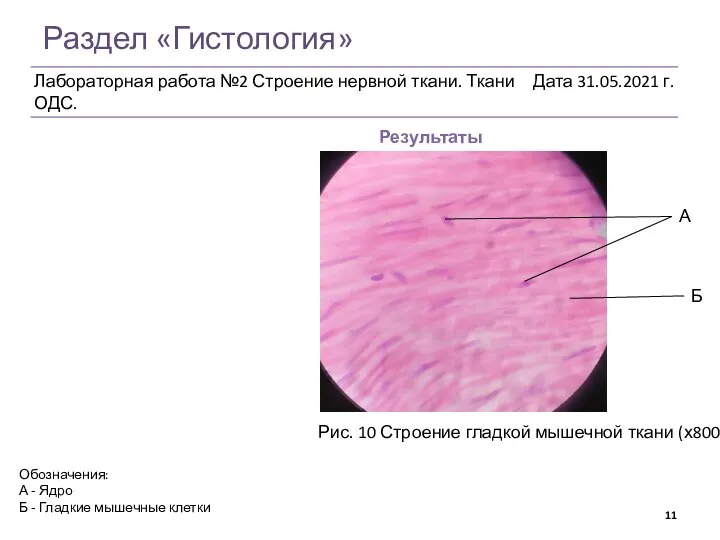 Раздел «Гистология» Результаты Рис. 10 Строение гладкой мышечной ткани (х800) Обозначения: А