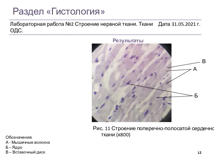 Раздел «Гистология» Результаты Рис. 11 Строение поперечно-полосатой сердечной ткани (х800) Обозначения: А