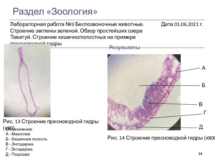 Раздел «Зоология» Результаты Рис. 14 Строение пресноводной гидры (х800) Обозначения: А -