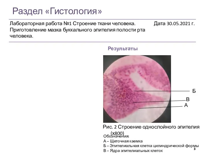 Раздел «Гистология» Результаты Рис. 2 Строение однослойного эпителия (х800) А Б В