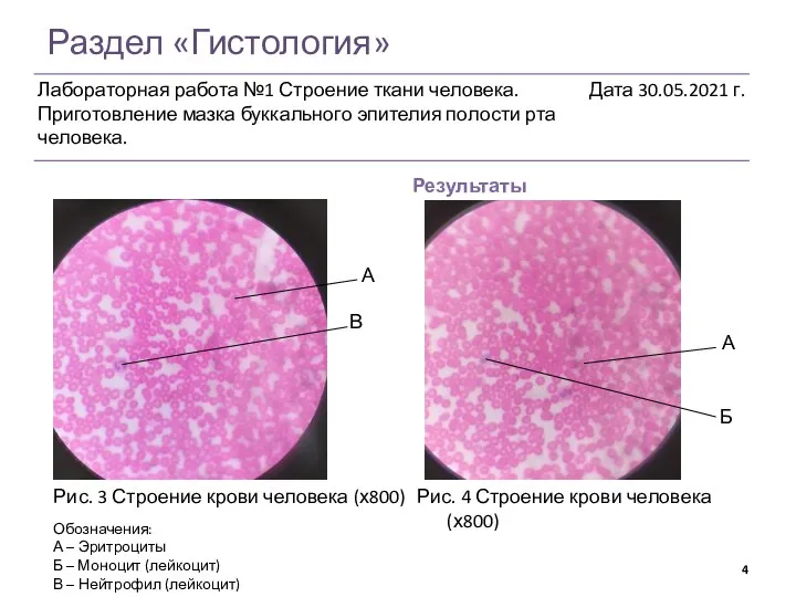 Раздел «Гистология» Результаты Рис. 4 Строение крови человека (х800) А Б В