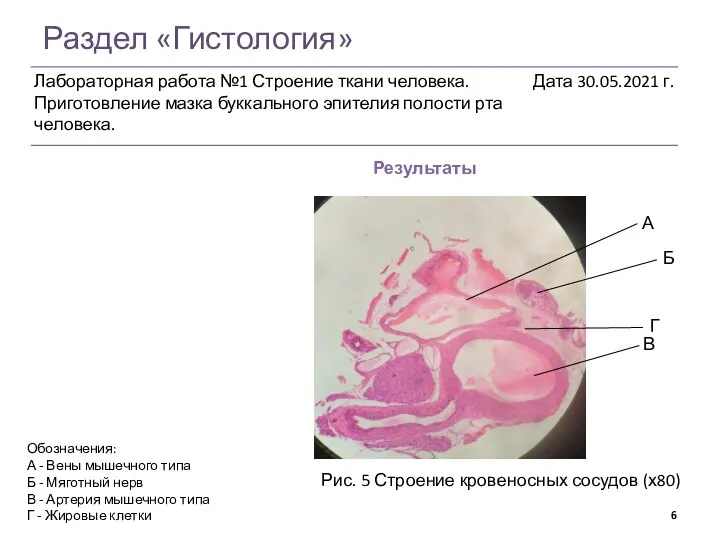 Раздел «Гистология» Результаты Рис. 5 Строение кровеносных сосудов (х80) Обозначения: А -