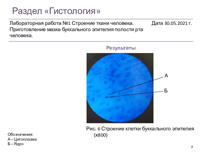 Раздел «Гистология» Результаты Рис. 6 Строение клетки буккального эпителия (х800) А Б