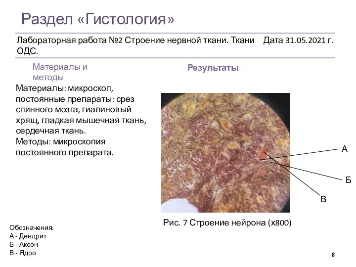 Раздел «Гистология» Результаты Рис. 7 Строение нейрона (х800) Обозначения: А - Дендрит