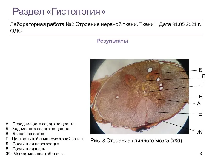 Раздел «Гистология» Результаты Рис. 8 Строение спинного мозга (х80) А Б А