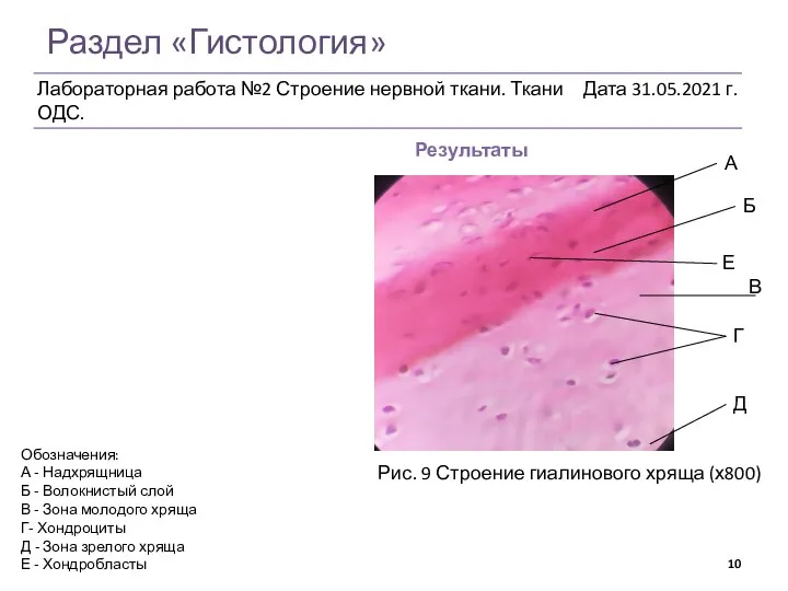 Раздел «Гистология» Результаты Рис. 9 Строение гиалинового хряща (х800) Обозначения: А -