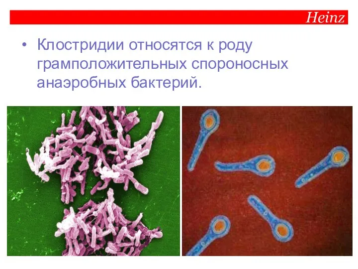 Heinz Клостридии относятся к роду грамположительных спороносных анаэробных бактерий.