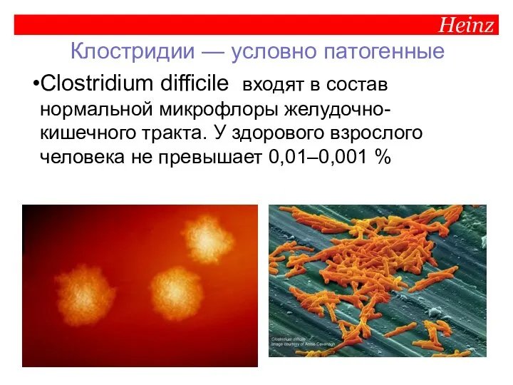 Heinz Клостридии — условно патогенные Clostridium difficile входят в состав нормальной микрофлоры