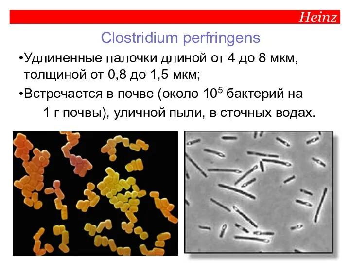 Heinz Clostridium perfringens Удлиненные палочки длиной от 4 до 8 мкм, толщиной