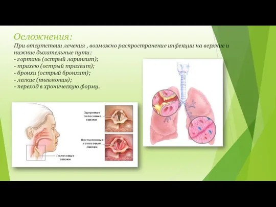 Осложнения: При отсутствии лечения , возможно распространение инфекции на верхние и нижние